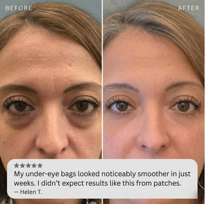 Ovalo Beauty MicroInfuse™ Eye Renewal Patches